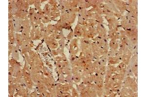 Immunohistochemistry of paraffin-embedded human heart tissue using ABIN7152346 at dilution of 1:100 (SULF2 抗体  (AA 463-660))