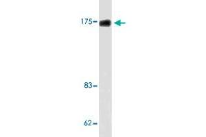 Western blot analysis of LoVo cell lysate with TOP2A polyclonal antibody .