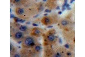 IHC-P analysis of Liver tissue, with DAB staining. (A1BG 抗体  (AA 220-415))