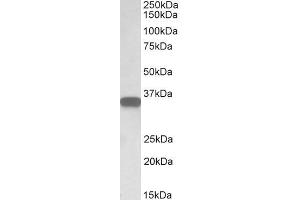 ABIN570905 (0. (CD20 抗体  (C-Term))