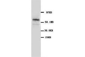 Western blot analysis of rat pancreas tissue lysis using GLAST antibody (SLC1A3 抗体  (C-Term))