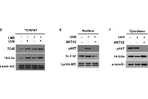 Western Blotting (WB) image for anti-Stratifin (SFN) antibody (ABIN2854867)