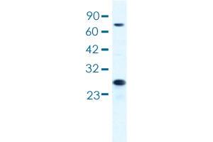 Western blot analysis of HepG2 cell lysate with MCM6 polyclonal antibody .