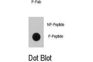Image no. 1 for anti-B-Raf proto-oncogene, serine/threonine kinase (BRAF) (pThr400) antibody (ABIN358444)