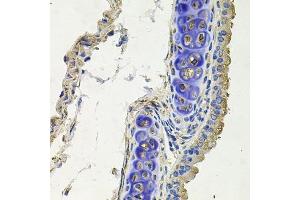 Immunohistochemistry of paraffin-embedded mouse lung using SKP1 antibody. (SKP1 抗体  (AA 1-163))