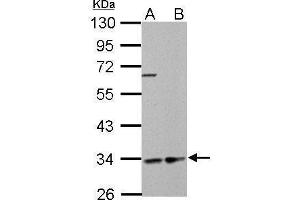 WB Image HADH antibody detects HADH protein by Western blot analysis.
