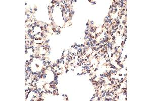 Immunohistochemistry of paraffin-embedded rat lung using BCL2L14/BCL2L14/BCLG Rabbit mAb (ABIN7265865) at dilution of 1:100 (40x lens).