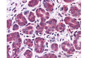 Anti-RBBP8 / CTIP antibody IHC of human breast. (Retinoblastoma Binding Protein 8 抗体  (AA 452-747))