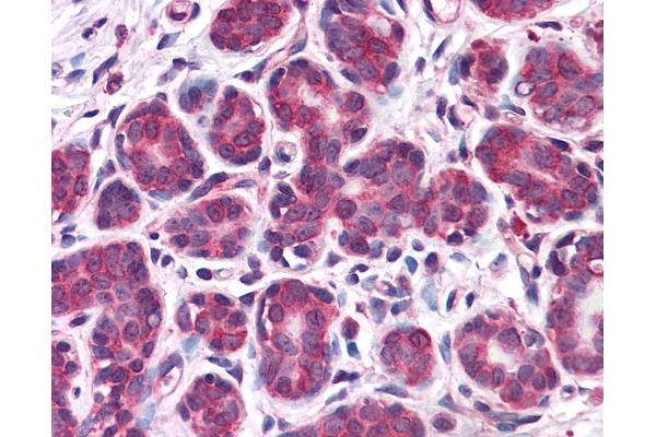 Retinoblastoma Binding Protein 8 抗体  (AA 452-747)