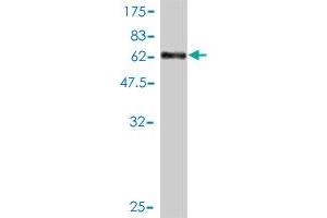Western Blotting (WB) image for anti-Melanoma Antigen Family A, 2 (MAGEA2) (AA 1-314) antibody (ABIN561729)