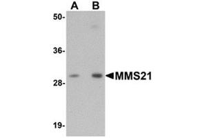 Western blot analysis of MMS21 in 293 cell lysate with MMS21 antibody at (A) 0. (NSMCE2 抗体  (C-Term))