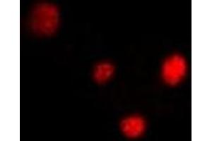 Immunofluorescent analysis of PPAR delta staining in U2OS cells. (PPARD 抗体)
