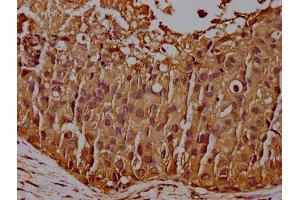 Immunohistochemistry (IHC) image for anti-CD44 (CD44) (AA 21-220) antibody (ABIN7147160)