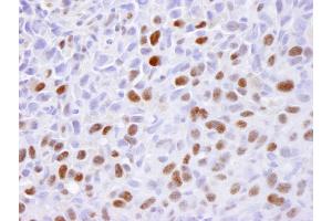 Immunohistochemistry (IHC) image for anti-Minichromosome Maintenance Complex Component 2 (MCM2) (AA 1-50) antibody (ABIN7448987)