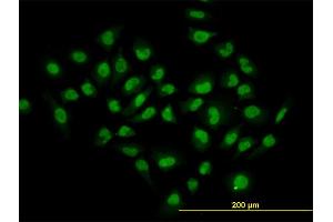 Immunofluorescence of monoclonal antibody to HDAC1 on HeLa cell. (HDAC1 抗体  (AA 1-482))