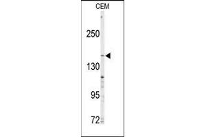 Western Blotting (WB) image for anti-ATP-Binding Cassette, Sub-Family C (CFTR/MRP), Member 4 (ABCC4) (C-Term) antibody (ABIN359599)