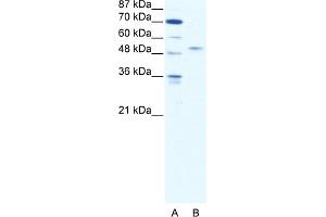 WB Suggested Anti-IRF5 Antibody Titration:  2. (IRF5 抗体  (N-Term))