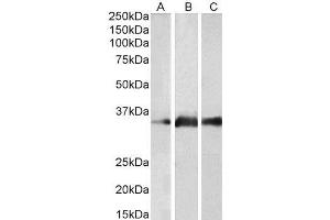 ABIN190841 (2µg/ml) staining of Human Brain (Cerebellum) (A), Mouse Brain (B) and Rat Brain (C) lysates (35µg protein in RIPA buffer). (Kallikrein 5 抗体  (Internal Region))