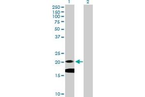 Western Blot analysis of IL7 expression in transfected 293T cell line by IL7 MaxPab polyclonal antibody. (IL-7 抗体  (AA 1-177))