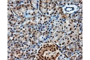 Immunohistochemical staining of paraffin-embedded liver tissue using anti-PTPRE mouse monoclonal antibody. (PTPRE 抗体)