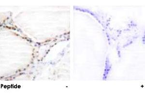 Immunohistochemical analysis of paraffin-embedded human thyroid gland tissue using VDR polyclonal antibody . (Vitamin D Receptor 抗体  (Ser208))