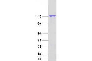 Western Blotting (WB) image for Synuclein, alpha Interacting Protein (SNCAIP) protein (Myc-DYKDDDDK Tag) (ABIN2733104)