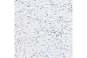 Immunohistochemistry (IHC) image for anti-Neural Precursor Cell Expressed, Developmentally Down-Regulated 9 (NEDD9) (AA 60-174) antibody (ABIN3023331)