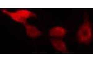 ABIN6266493 staining HeLa cells by IF/ICC. (RAD17 抗体  (C-Term))