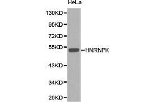 Western Blotting (WB) image for anti-Heterogeneous Nuclear Ribonucleoprotein K (HNRNPK) antibody (ABIN1873067) (HNRNPK 抗体)