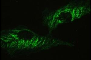 Immunocytochemistry (ICC) image for anti-Ataxin 2 (ATXN2) (C-Term) antibody (ABIN3028477)