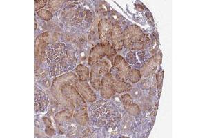 Immunohistochemical staining (Formalin-fixed paraffin-embedded sections) of human kidney with SAV1 polyclonal antibody  shows strong cytoplasmic positivity in renal tubules. (SAV1 抗体)