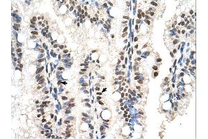 Immunohistochemistry (IHC) image for anti-RUN Domain Containing 2A (RUNDC2A) (N-Term) antibody (ABIN2783094) (SNX29 抗体  (N-Term))