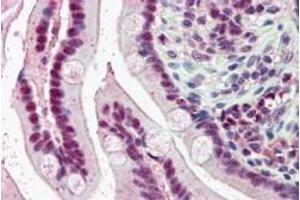 Immunohistochemistry (IHC) image for anti-Karyopherin (Importin) alpha 4 (KPNA4) (C-Term) antibody (ABIN185160)