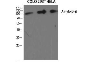 Western Blot analysis of various cells using Amyloid-β Polyclonal Antibody diluted at 1:2000.
