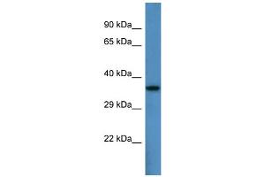 Host:  Rabbit  Target Name:  Pard6b  Sample Type:  Mouse Heart lysates  Antibody Dilution:  1. (PARD6B 抗体  (N-Term))