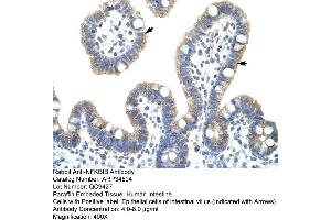Human Intestine (NFKBIB 抗体  (C-Term))