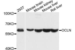 Western blot analysis of extracts of various cell lines, using OCLN antibody (ABIN4904607) at 1:1000 dilution. (Occludin 抗体)