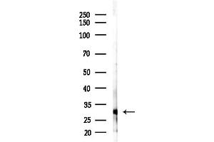 Western blot analysis of lysates from F10-LUC cells(starvation,24h treatment), using OR6C75 Antibody at 1/1000 dilution.