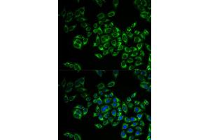 Immunofluorescence analysis of MCF-7 cell using FIS1 antibody. (Fission 1 抗体)