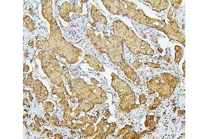 IHC analysis of SLC9A3R1 using anti-SLC9A3R1 antibody (ABIN6719642).