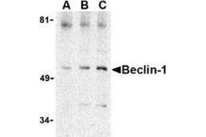 AP20057PU-N Beclin-1 antibody staining of A431 cell lysate by Western Blotting at (A) 0. (Beclin 1 抗体  (C-Term))