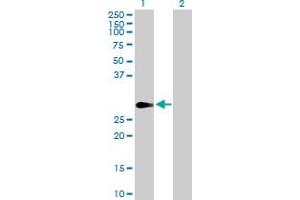Western Blot analysis of FHL1 expression in transfected 293T cell line by FHL1 MaxPab polyclonal antibody. (FHL1 抗体  (AA 1-280))