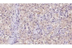 Immunohistochemistry (IHC) image for anti-Voltage-Dependent Anion Channel 3 (VDAC3) (N-Term) antibody (ABIN6265960)