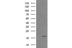 Image no. 1 for anti-Cancer/testis Antigen 1B (CTAG1B) antibody (ABIN1499889) (CTAG1B 抗体)