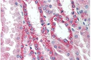Human Kidney (formalin-fixed, paraffin-embedded) stained with SNF1LK2 antibody ABIN297633 at 10 ug/ml followed by biotinylated goat anti-rabbit IgG secondary antibody ABIN481713, alkaline phosphatase-streptavidin and chromogen. (SIK2 抗体  (AA 100-150))