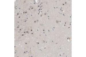 Immunohistochemical staining of human hippocampus with NOL11 polyclonal antibody  shows strong nucleolar positivity in neuronal cells at 1:20-1:50 dilution. (NOL11 抗体)