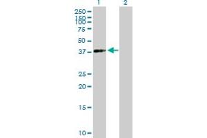 Western Blot analysis of ACTRT2 expression in transfected 293T cell line by ACTRT2 MaxPab polyclonal antibody. (ACTRT2 抗体  (AA 1-377))