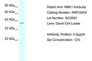 WB Suggested Anti-HMX1 AntibodyTitration: 4. (HMX1 抗体  (Middle Region))