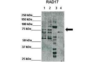 WB Suggested Anti-RAD17 Antibody  Positive Control: Lane1: 25ug Hela lysate, Lane2: 25ug HEK293T lysate, Lane3: 25ug Xenopus laevis egg extract, Lane4: 25ug mouse embryonic stem cells lysate Primary Antibody Dilution :  1:500 Secondary Antibody :  Anti-rabbit-HRP  Secondry Antibody Dilution :  1:3000 Submitted by: Domenico Maiorano, Institute of Human Genetics, CNRS (RAD17 抗体  (C-Term))