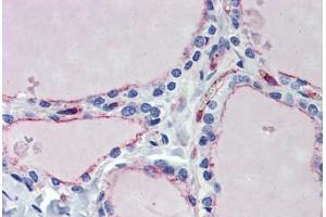 Thyroid, Human: Formalin-Fixed, Paraffin-Embedded (FFPE) (EHD4 抗体  (AA 396-445))